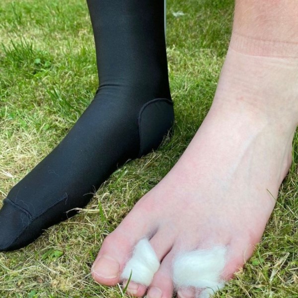 how to stop shoes from blistering